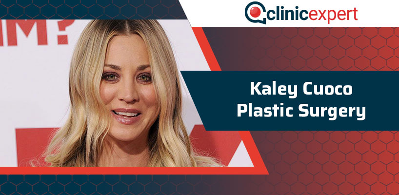 Kaley Cuoco Plastic Surgery