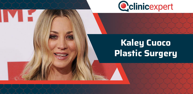 Kaley Cuoco Plastic Surgery | ClinicExpert