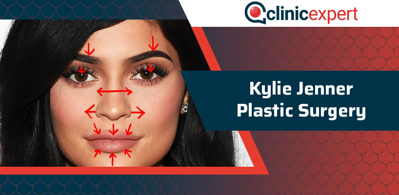 Kylie Jenner Plastic Surgery