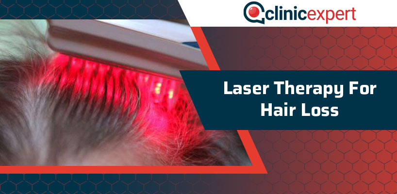 Laser Therapy For Hair Loss