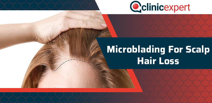 Microblading for Scalp Hair Loss