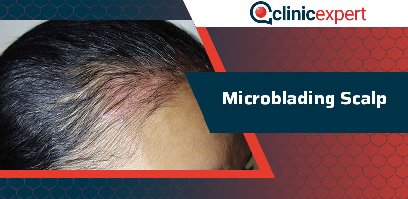Microblading Scalp