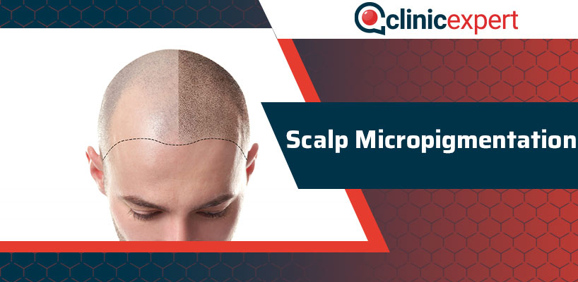 Scalp Micropigmentation