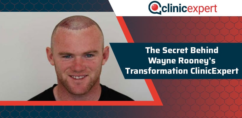 The Secret Behind Wayne Rooney's Transformation