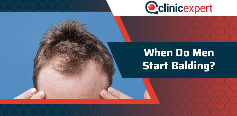 When Do Men Start Balding?