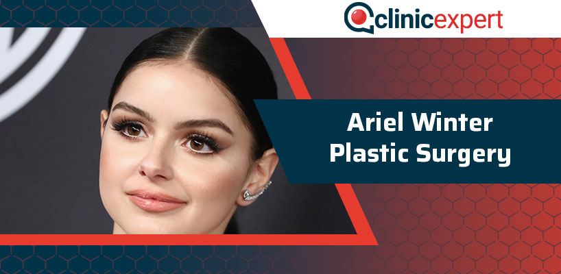 Ariel Winter Plastic Surgery | Clinicexpert