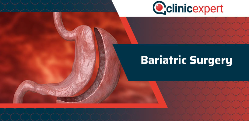 Bariatric Surgery gastric band surgery turkey