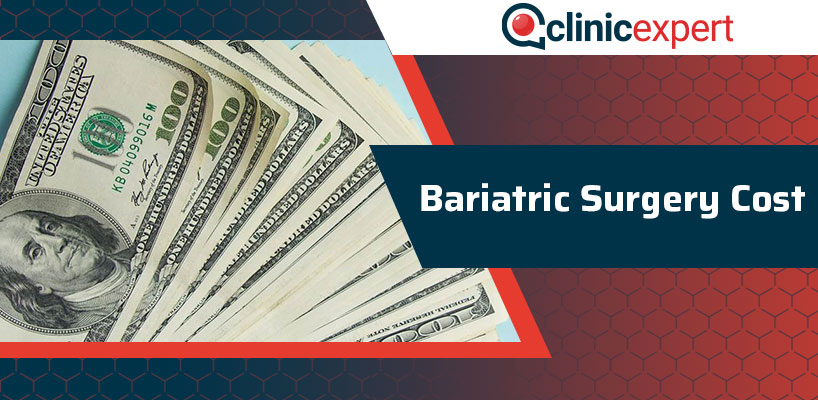 Gastric Sleeve Cost Turkey