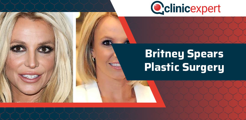 Britney Spears Plastic Surgery