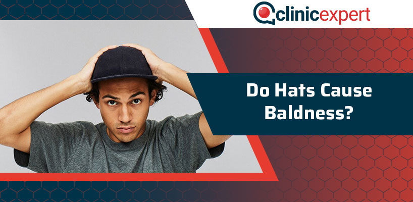 Do Hats Cause Baldness?
