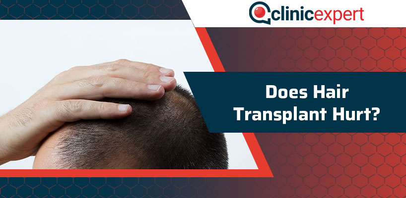 Does Hair Transplant Hurt?