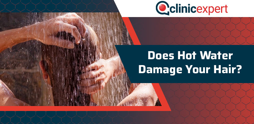 Does Hot Water Damage Your Hair? | ClinicExpert