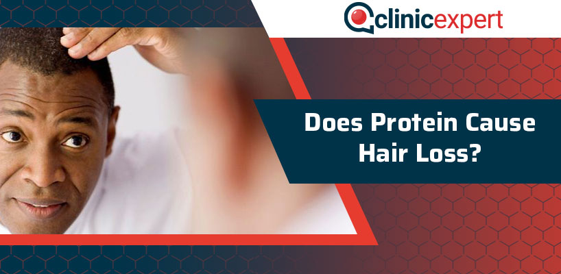 Does Protein Cause Hair Loss?