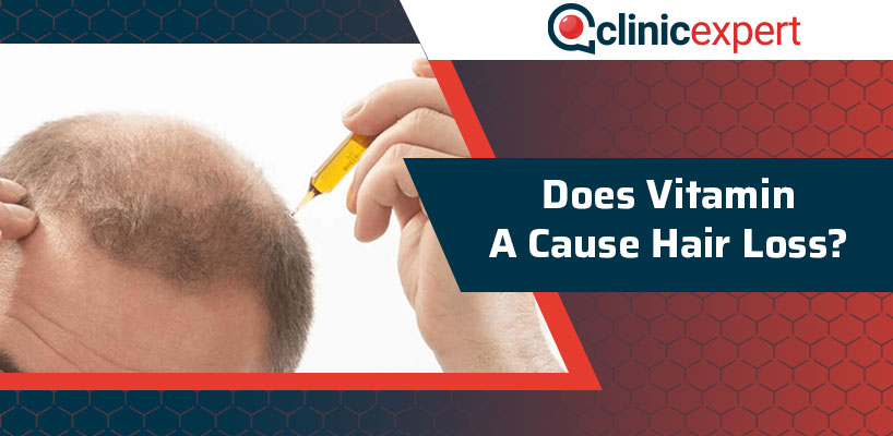 Does Vitamin A Cause Hair Loss?