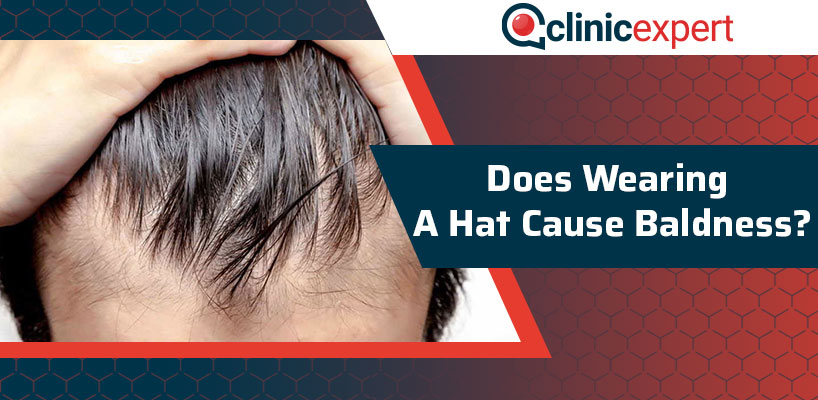 Does Wearing a Hat Cause Baldness? | ClinicExpert