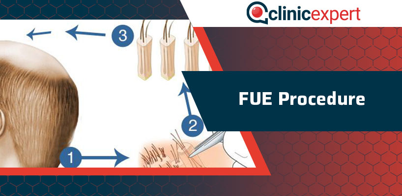 FUE Procedure