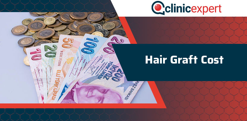 Hair Graft Cost