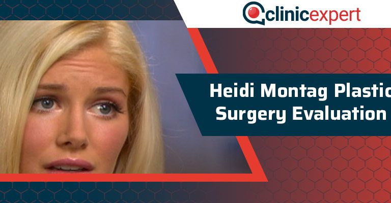 Heidi Montag Plastic Surgery Evaluation