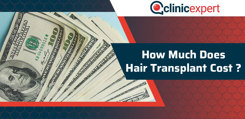 How Much Does Hair Transplant Cost? | ClinicExpert