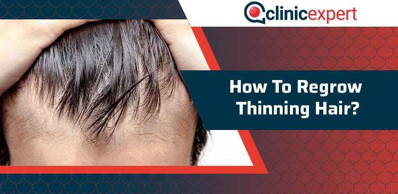 How To Regrow Thinning Hair?