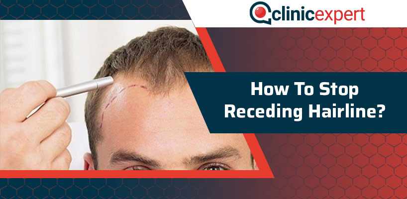 How To Stop Receding Hairline?