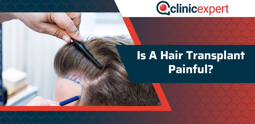 Is A Hair Transplant Painful?