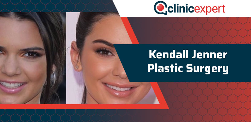 Kendall Jenner Plastic Surgery