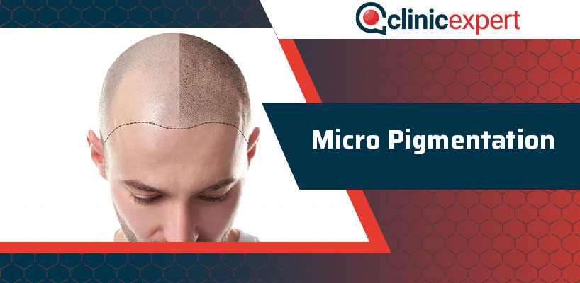 Micro Pigmentation