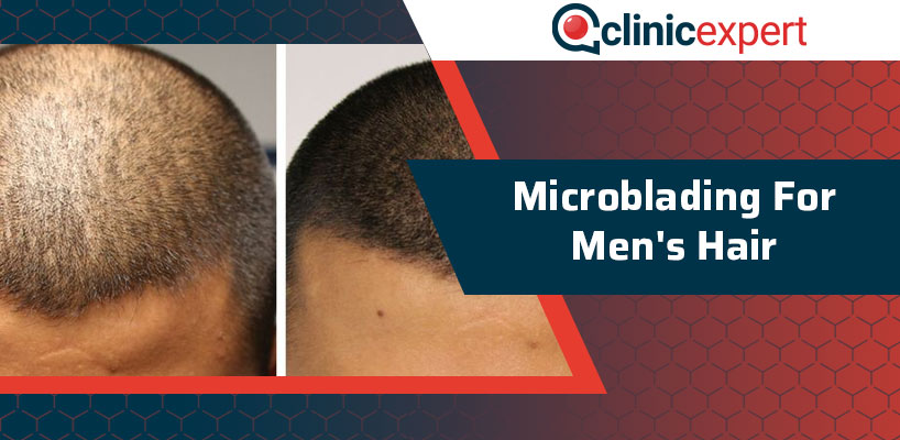 Microblading For Men's Hair