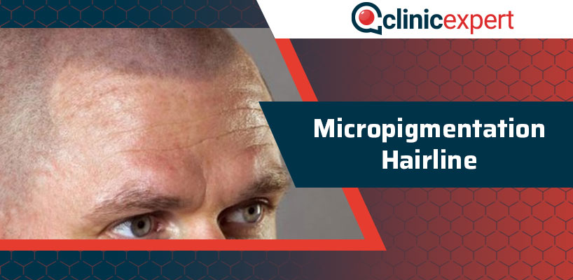 Micropigmentation Hairline