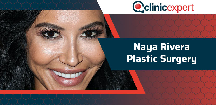 Naya Rivera Plastic Surgery
