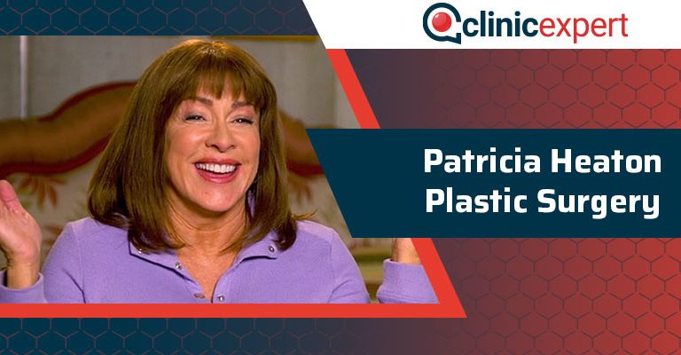 Patricia Heaton Plastic Surgery