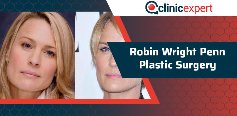 Robin Wright Penn Plastic Surgery