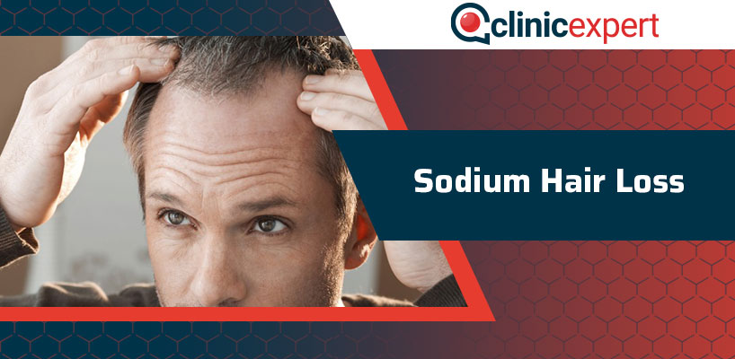 Sodium Hair Loss