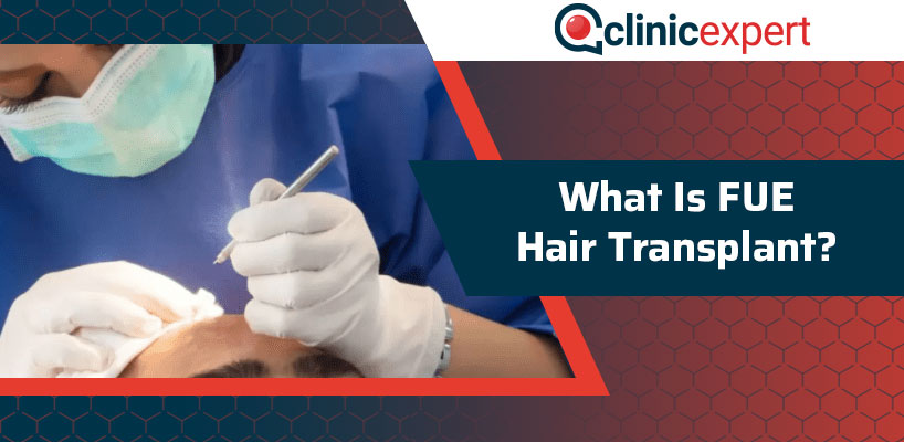 What Is FUE Hair Transplant?