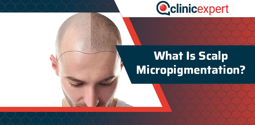 What Is Scalp Micropigmentation?