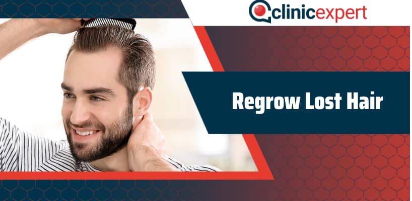How to regrow lost hair