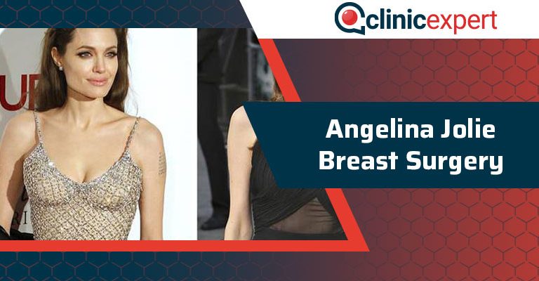 Angelina Jolie Breast Surgery