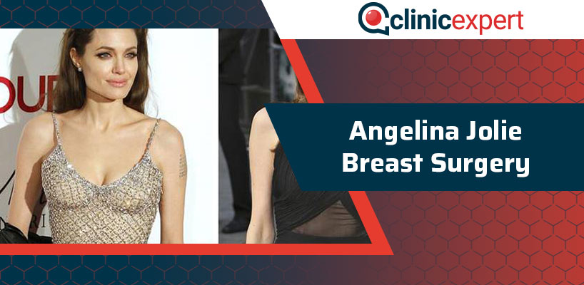 Angelina Jolie Breast Surgery