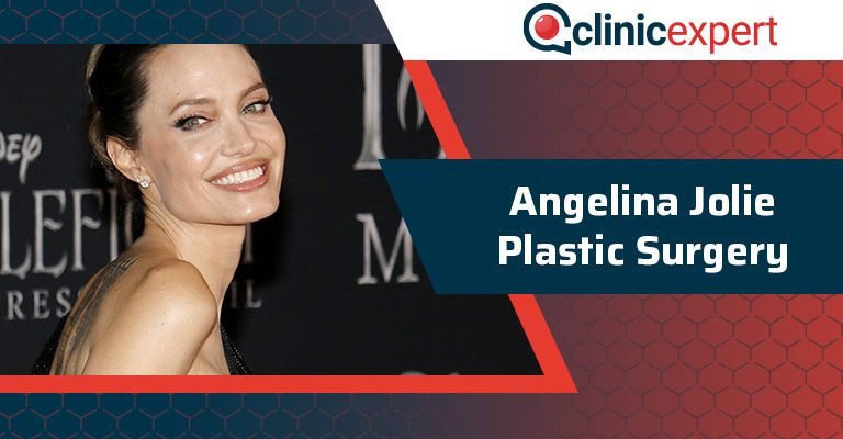 Angelina Jolie Plastic Surgery