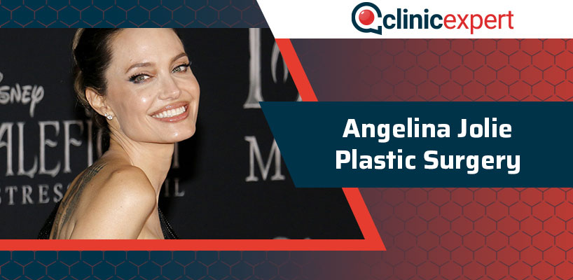 Angelina Jolie Plastic Surgery