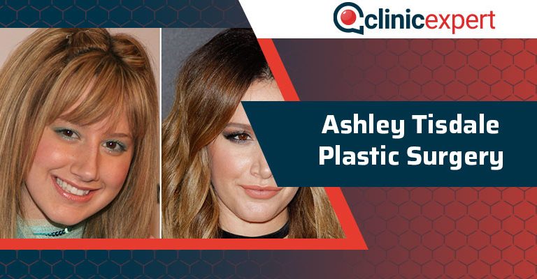 Ashley Tisdale Plastic Surgery