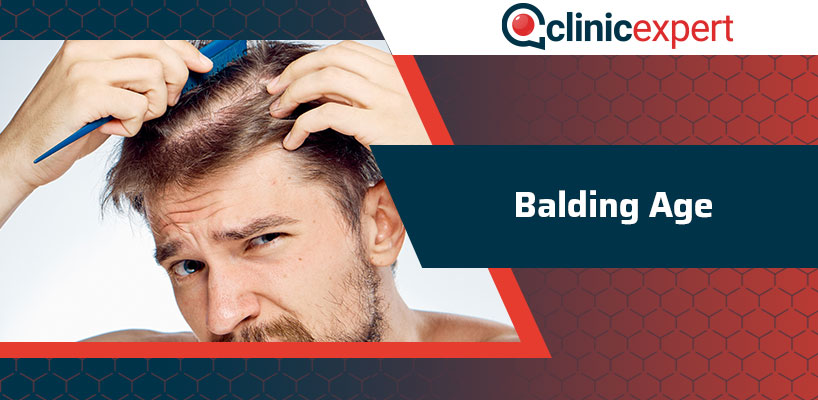 Balding Age