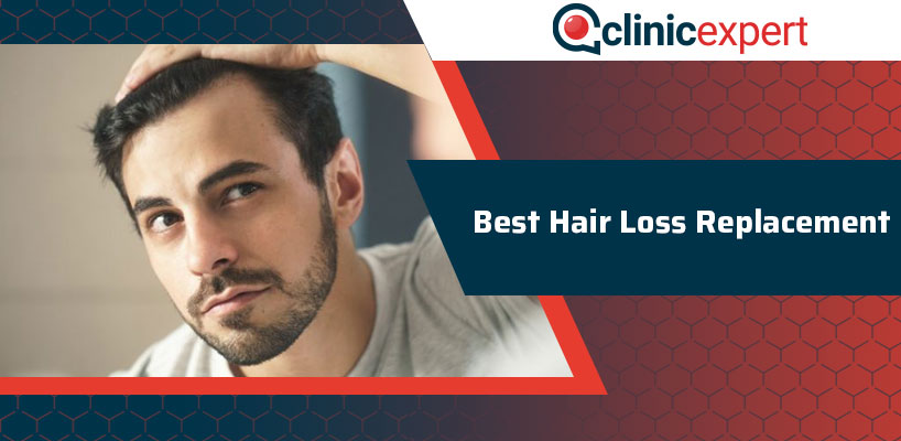 Best Hair Loss Replacement