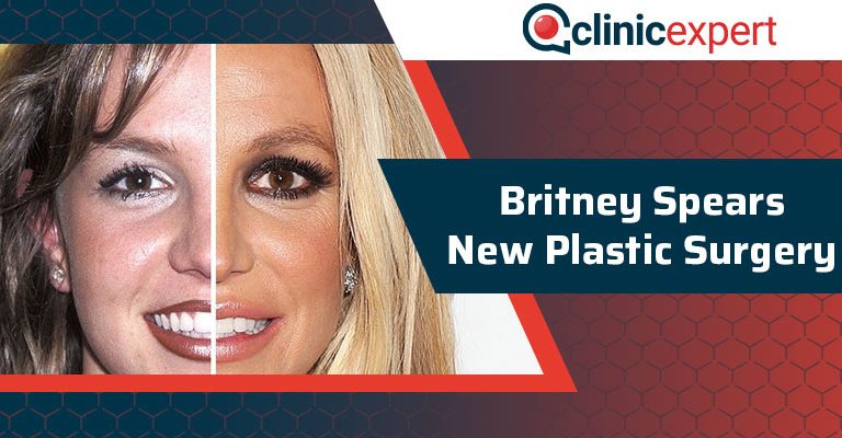 Britney Spears New Plastic Surgery
