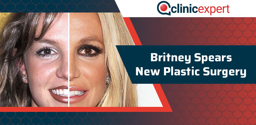 Britney Spears New Plastic Surgery