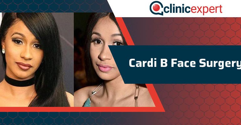 Cardi B Face Surgery