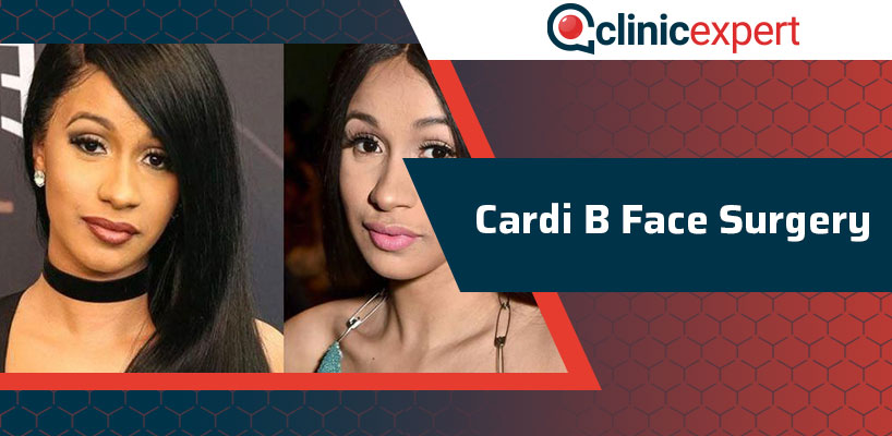 Cardi B Face Surgery