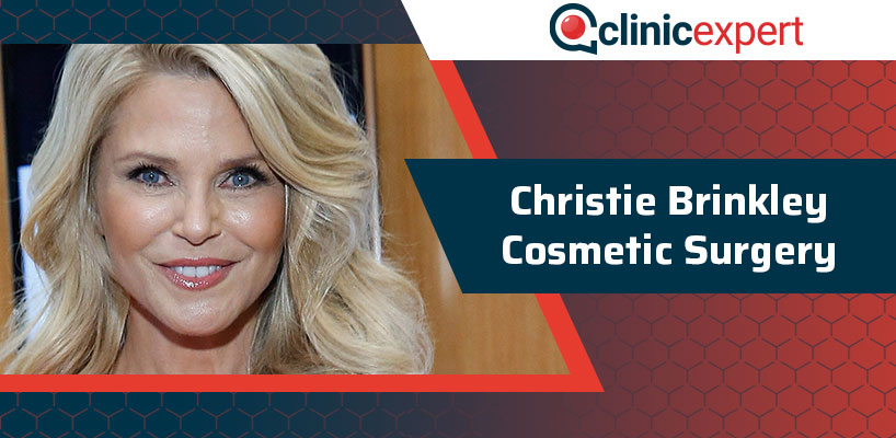 Christie Brinkley Cosmetic Surgery 