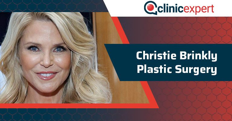 Christie Brinkly Plastic Surgery